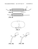 OPHTHALMIC IMPLANT FOR TREATMENT OF GLAUCOMA diagram and image