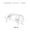 OPHTHALMIC IMPLANT FOR TREATMENT OF GLAUCOMA diagram and image