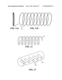 OPHTHALMIC IMPLANT FOR TREATMENT OF GLAUCOMA diagram and image