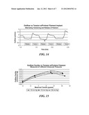 OPHTHALMIC IMPLANT FOR TREATMENT OF GLAUCOMA diagram and image