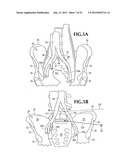 INSERTION DEVICE FOR USE DURING RETROPERITONEAL LATERAL INSERTION OF     SPINAL IMPLANTS diagram and image