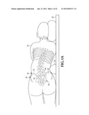 SPINAL IMPLANT FOR USE DURING RETROPERITONEAL LATERAL INSERTION PROCEDURES diagram and image