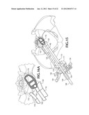 SPINAL IMPLANT FOR USE DURING RETROPERITONEAL LATERAL INSERTION PROCEDURES diagram and image