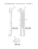 SPINAL IMPLANT FOR USE DURING RETROPERITONEAL LATERAL INSERTION PROCEDURES diagram and image