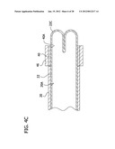 CURED IN PLACE LINER SYSTEM AND INSTALLATION METHODS diagram and image