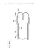 CURED IN PLACE LINER SYSTEM AND INSTALLATION METHODS diagram and image