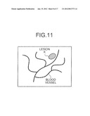 IMAGE PROCESSING APPARATUS, IMAGING APPARATUS, COMPUTER-READABLE STORAGE     MEDIUM, AND IMAGE PROCESSING METHOD diagram and image