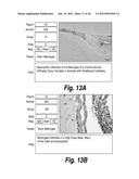 METHODS AND COMPOSITIONS FOR CNS DELIVERY OF HEPARAN N-SULFATASE diagram and image