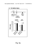 PREVENTION AND TREATMENT OF PAIN USING ANTIBODIES TO LYSOPHOSPHATIDIC ACID diagram and image