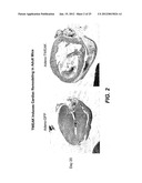 METHODS FOR TREATING TWEAK-RELATED CONDITIONS diagram and image