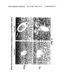 METHODS FOR TREATING TWEAK-RELATED CONDITIONS diagram and image