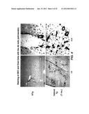 METHODS FOR TREATING TWEAK-RELATED CONDITIONS diagram and image