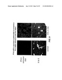 METHODS FOR TREATING TWEAK-RELATED CONDITIONS diagram and image