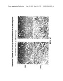 METHODS FOR TREATING TWEAK-RELATED CONDITIONS diagram and image