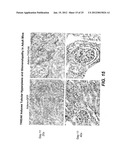 METHODS FOR TREATING TWEAK-RELATED CONDITIONS diagram and image