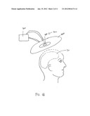 DEVICE AND METHOD FOR PROVIDING A SYNERGISTIC COMBINATION  OF PHOTOTHERAPY     AND A NON-LIGHT ENERGY MODALITY TO THE BRAIN diagram and image