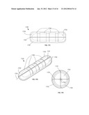 IMPLANTS FOR USE IN BRACHYTHERAPY AND OTHER RADIATION THERAPY THAT RESIST     MIGRATION AND ROTATION diagram and image