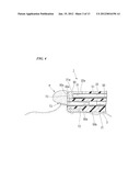 ENDOSCOPE TREATMENT INSTRUMENT diagram and image