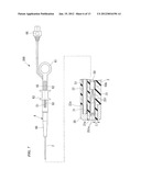 ENDOSCOPE TREATMENT INSTRUMENT diagram and image