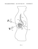 ENERGETIC MODULATION OF NERVES diagram and image