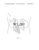 ENERGETIC MODULATION OF NERVES diagram and image