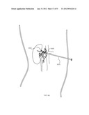 ENERGETIC MODULATION OF NERVES diagram and image