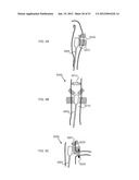 ENERGETIC MODULATION OF NERVES diagram and image