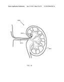 ENERGETIC MODULATION OF NERVES diagram and image