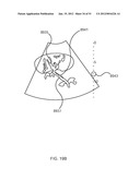 ENERGETIC MODULATION OF NERVES diagram and image