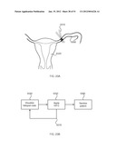 ENERGETIC MODULATION OF NERVES diagram and image