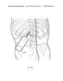 ENERGETIC MODULATION OF NERVES diagram and image