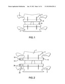 SYSTEM, APPARATUS, AND METHOD FOR IN-VIVO ASSESSMENT OF RELATIVE POSITION     OF AN IMPLANT diagram and image