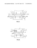 SYSTEM, APPARATUS, AND METHOD FOR IN-VIVO ASSESSMENT OF RELATIVE POSITION     OF AN IMPLANT diagram and image