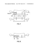 SYSTEM, APPARATUS, AND METHOD FOR IN-VIVO ASSESSMENT OF RELATIVE POSITION     OF AN IMPLANT diagram and image