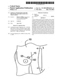 SURGICAL SYSTEM WITH CLIPS FOR IDENTIFYING THE ORIENTATION OF A TISSUE     SAMPLE diagram and image