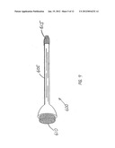 SURGICAL SYSTEM WITH CLIPS FOR IDENTIFYING THE ORIENTATION OF A TISSUE     SAMPLE diagram and image