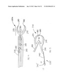 SURGICAL SYSTEM WITH CLIPS FOR IDENTIFYING THE ORIENTATION OF A TISSUE     SAMPLE diagram and image