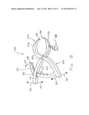 SURGICAL SYSTEM WITH CLIPS FOR IDENTIFYING THE ORIENTATION OF A TISSUE     SAMPLE diagram and image