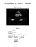 ULTRASONIC DIAGNOSTIC APPARATUS AND METHOD THEREOF diagram and image