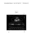 ULTRASONIC DIAGNOSTIC APPARATUS AND METHOD THEREOF diagram and image