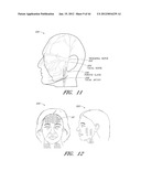 SYSTEMS FOR COSMETIC TREATMENT diagram and image