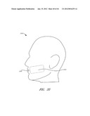 SYSTEMS FOR COSMETIC TREATMENT diagram and image