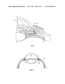 OCULAR IMPLANT WITH STIFFNESS QUALITIES, METHODS OF IMPLANTATION AND     SYSTEM diagram and image