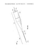 OCULAR IMPLANT WITH STIFFNESS QUALITIES, METHODS OF IMPLANTATION AND     SYSTEM diagram and image