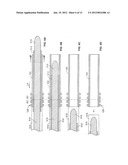 OCULAR IMPLANT WITH STIFFNESS QUALITIES, METHODS OF IMPLANTATION AND     SYSTEM diagram and image