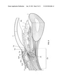 OCULAR IMPLANT WITH STIFFNESS QUALITIES, METHODS OF IMPLANTATION AND     SYSTEM diagram and image