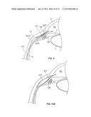 OCULAR IMPLANT WITH STIFFNESS QUALITIES, METHODS OF IMPLANTATION AND     SYSTEM diagram and image