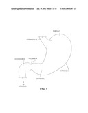 SATIATION DEVICES AND METHODS diagram and image