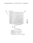 SATIATION DEVICES AND METHODS diagram and image