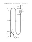 Interventional Devices Including Dilute Nanotube-Polymer Compositions, and     Methods of Making and Using Same diagram and image